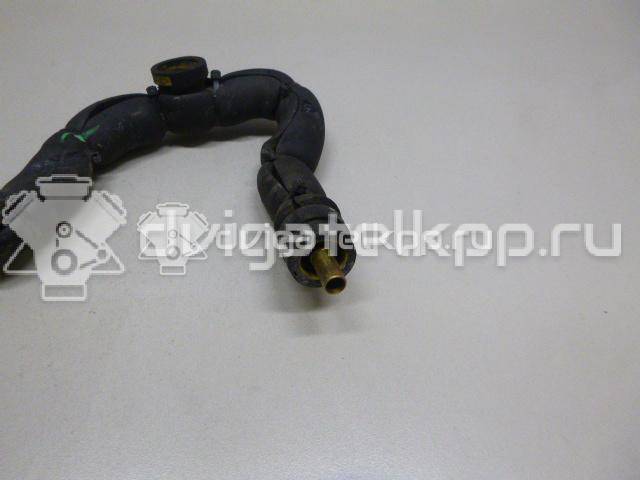 Фото Трубка картерных газов для двигателя KFX (TU3JP) для Citroen Zx N2 / Saxo S0, S1 / Xsara 72-75 л.с 8V 1.4 л бензин 1192WR {forloop.counter}}